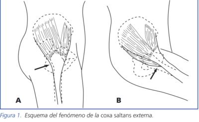 COXASALTANS